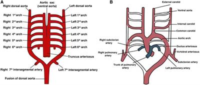 Persistent fifth aortic arch: a comprehensive literature review